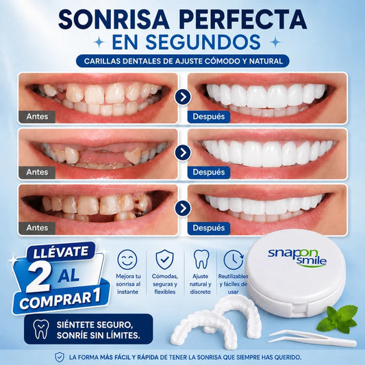Carillas dentales SNAPON SMILE